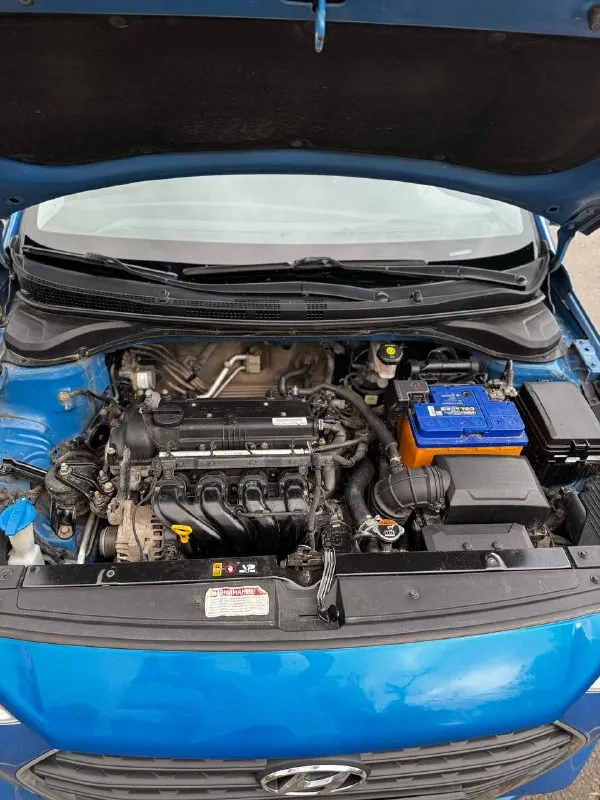 Hyundai solaris 1.6 2018 г. В.
Авто в идеальном состоянии полностью в заводском окрасе с пробегом 131 тыс. Км.
Последние 4 года автомобилем владела девушка!!
По комплектации
-Полный электропакет
-Кондиционер
-Подогрев передних сидений
-Мультимедиа aux/bt
-Сигнализация
-Abs/esp
-4 Airbag
Два ключа!!!
Автомобиль полностью обслужен,
Стоит новая летняя резина, зимний комплект колес также в наличии!! Новый акб
Тормоза полностью обслужены(всё новое)замена полностью всех фильтров и жидкостей включая и 500 км назад!!!
Стоимомость 1150000 ₽
Торг у капота!!!
Звоните +79495082418 (мах)
Тг вотсап +79493811593
📲 Tg: @kloyastarlink
📞 Звоните: +7(949)5082418 - фотография - 10